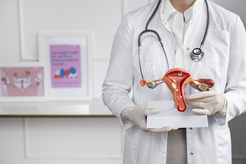 آخرین اخبار شرکت در مورد اندومتریوز به شدت با افزایش خطر سرطان تخمدان مرتبط است