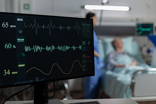 آخرین وبلاگ های شرکت در مورد درک فیبریلاسیون دهلیزی (AFib)